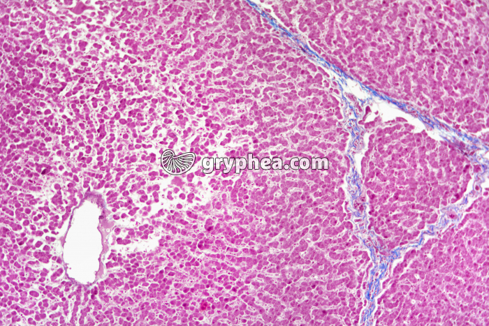 Foie de Porc (lobulation) x25 - gryphea.org